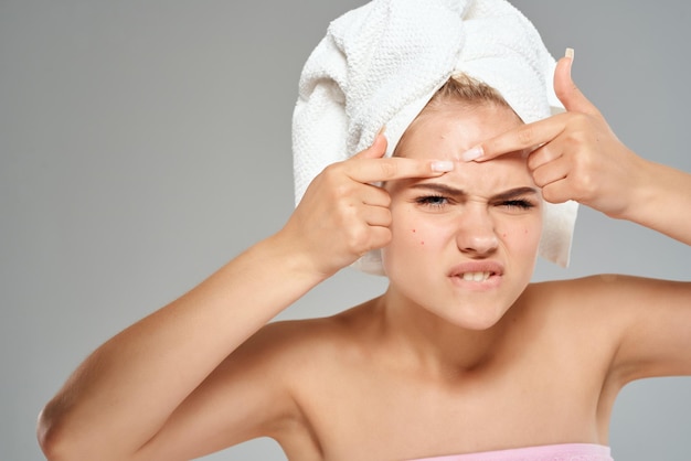 Woman with a towel on her head acne on her face dermatology skin care High quality photo