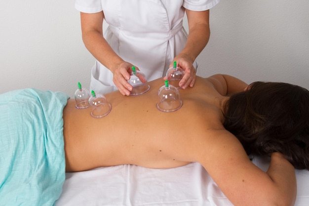 Woman with vacuum cups on her back