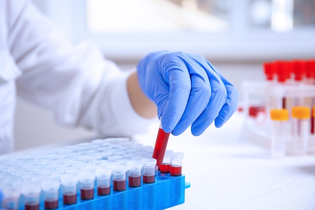 Woman working with blood samples in laboratory closeup