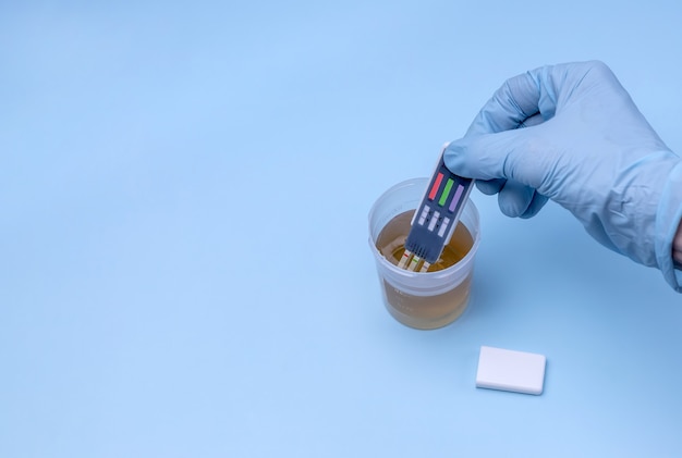 A womans hand lowers the test strips into a jar of urine