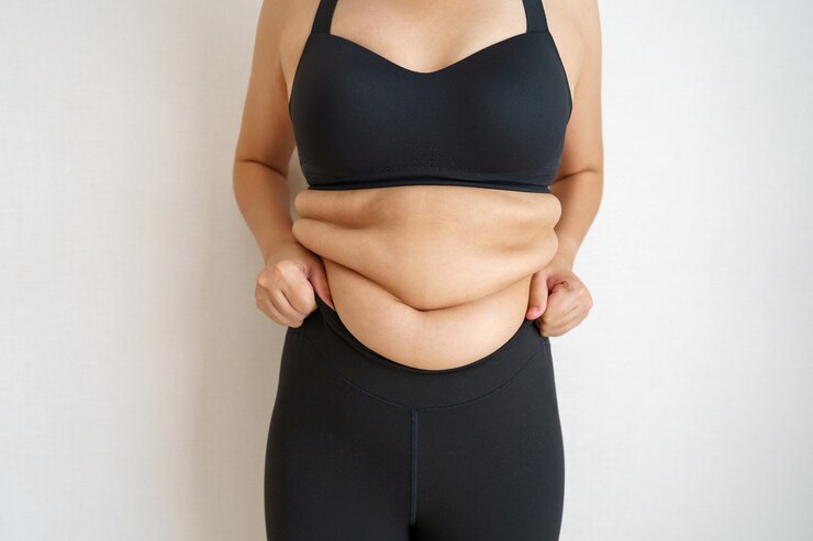 Photo women body fat belly. obese woman hand holding excessive belly fat.