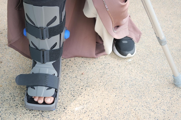 Women broken feet with a grey plastic boot ankle brace injury\
protecting boot