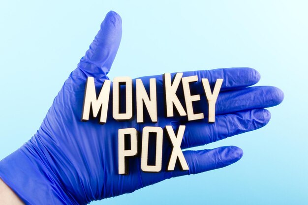 Wooden letters text MONKEYPOX on a doctor's hand in a blue glove Monkeypox virus concept