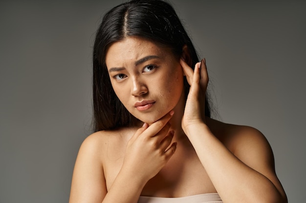 worried young asian woman with bare shoulders and acne prone skin on grey backdrop skin issues