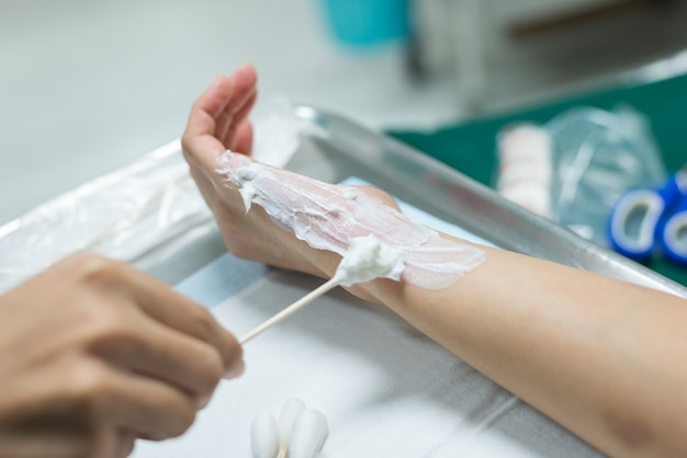 Wound burn dressing