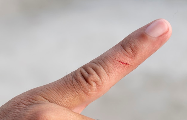 Photo wounded forefinger has blood stains