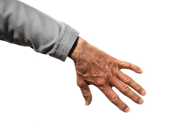 Wrinkled skin on hand