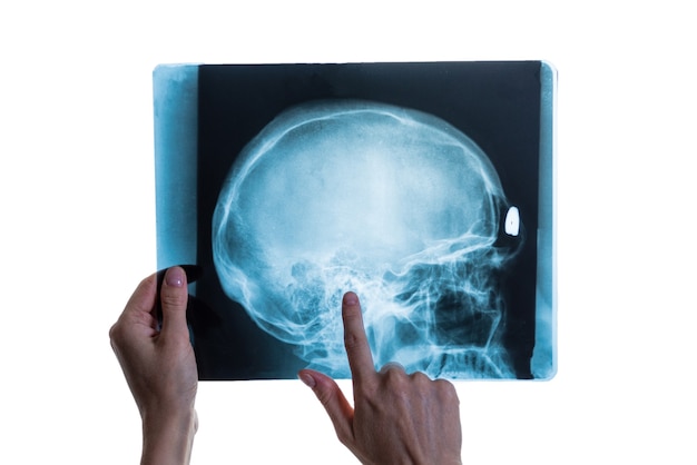 Рентгеновский анализ изображения головы черепа в руках специалиста, крупным планом