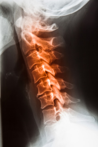 Pellicola radiografica per cranio umano