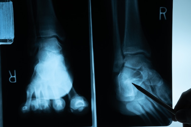 의사의 손으로 검사하는 X 레이 필름