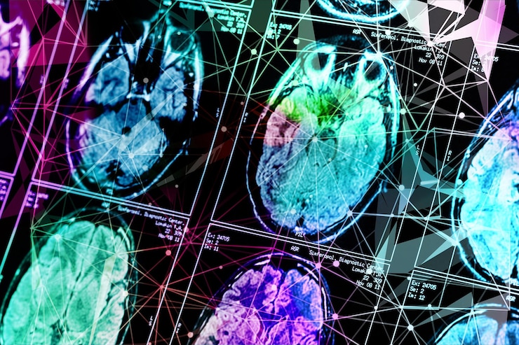 Photo x-ray image of the brain computed tomography