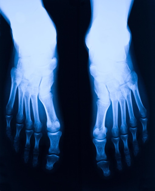 Foto immagine a raggi x dei piedi umani