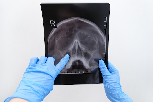 Фото Рентген черепа в руке женщины-врача. с копией пространства. диагностика гайморита