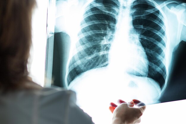 肺炎と癌の病院で胸部X線の医師が写真を見ています