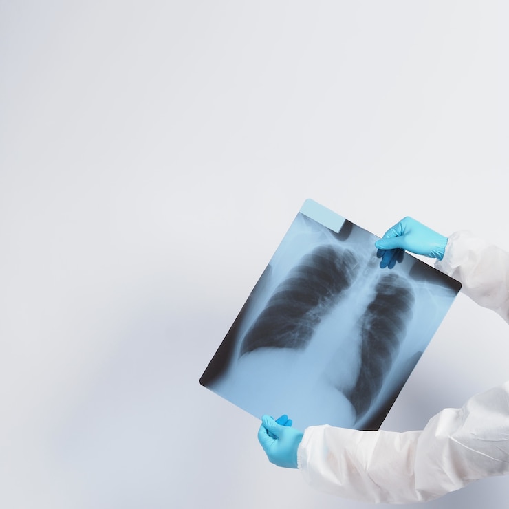 Photo xray film of covid 19 lung damage and holding by doctor hand in medical glove and ppe or personal