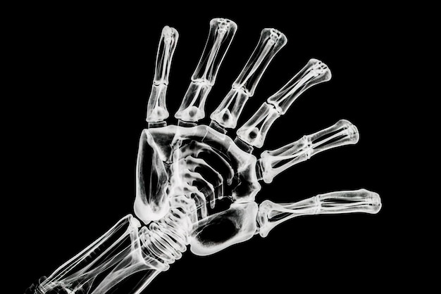 Xray image of a human hand on a black background Generative AI