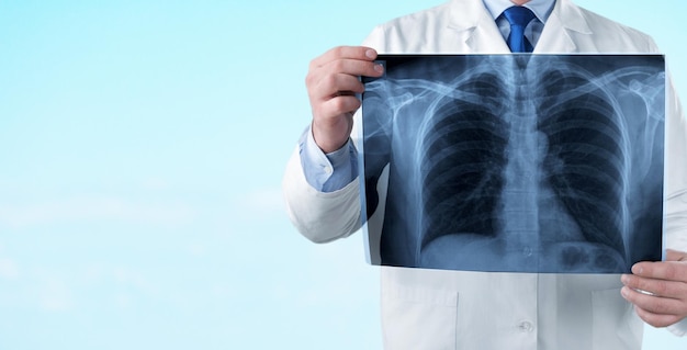 Xray radiology doctor hospital disease radiography ray