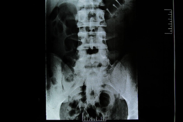 Фото Рентгеновское фото концепции здоровья позвоночника