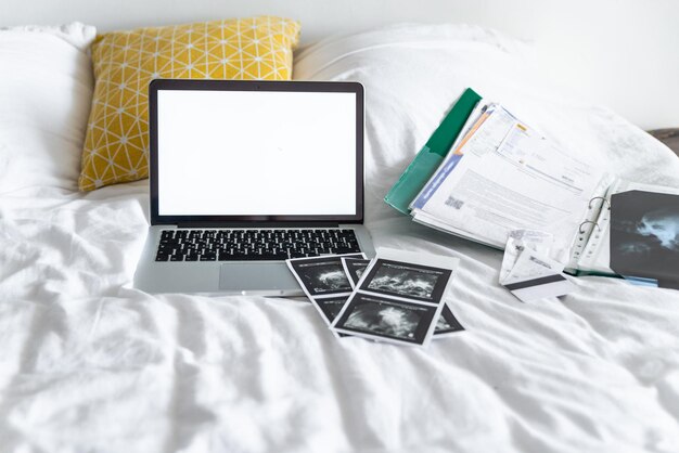 침대 의료 개념에 흰색 화면이 있는 Xray 초음파 검사 노트북
