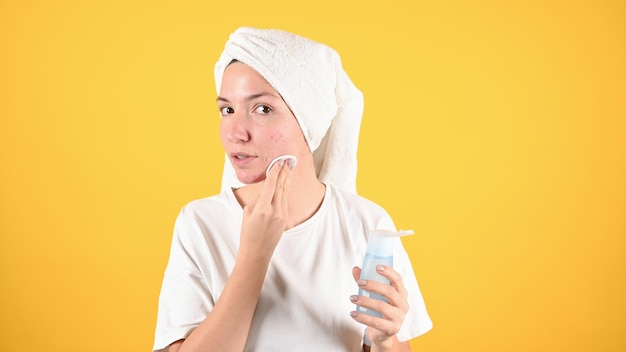 Yong-vrouw met een handdoek op haar hoofd zorgt voor een probleemhuid Cosmetica voor een probleemhuidprobleem