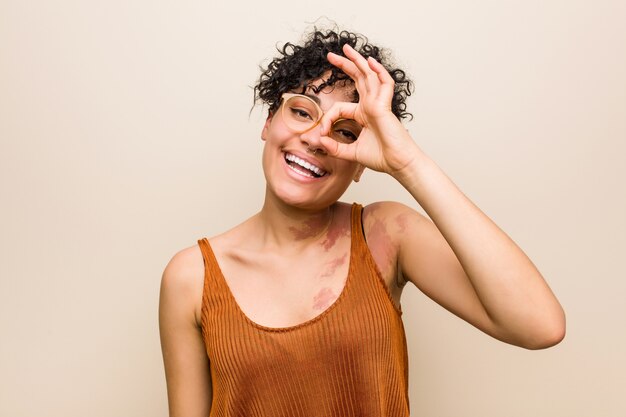肌のあざを持つ若いアフリカ系アメリカ人女性は、目で[ok]ジェスチャーを維持する興奮しています。