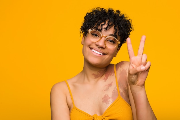Young african american woman with skin mark showing number two with fingers.
