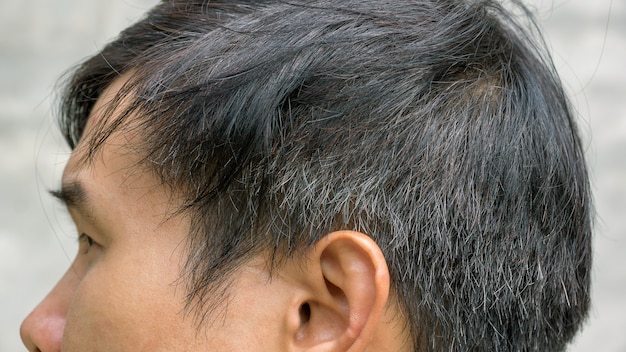 Young asian man has a gray hair.