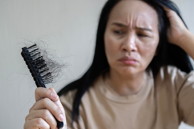 사진 젊은 아시아 여성은 탈모 고민 머리 때문에 매우 화가