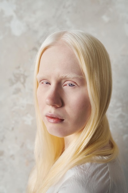 Photo young beautiful albino woman with no makeup looking at camera