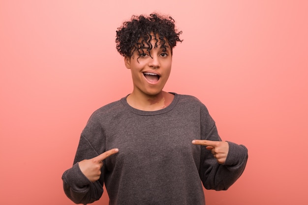 Young beautiful and natural african american woman with a birthmark