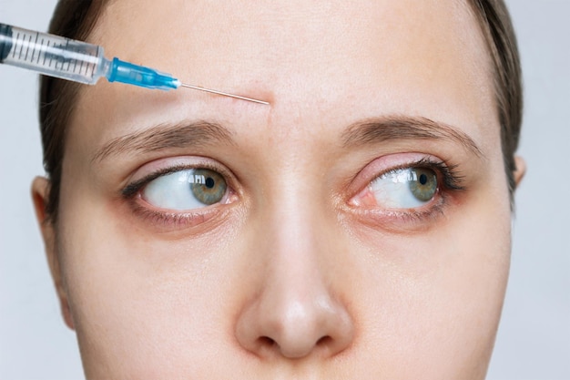 Young caucasian woman with wrinkles on the forehead with a syringe needle for botox procedure