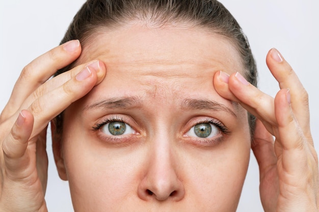 Young caucasian worried woman touching the forehead demonstrating wrinkles on her face