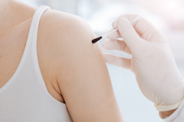 Young confident optimistic patient sitting in the clinic and getting treatment while pediatrician applying the cotton swab with iodine on the skin of the teenager