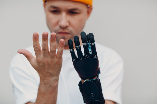 Young disabled man checking and looking on artificial prosthetic hand and compare with healthy hand