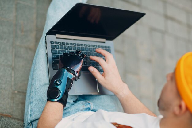 Young disabled man with artificial prosthetic hand using typing on laptop computer keyboard