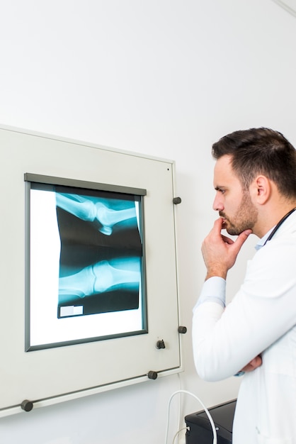 Young doctor analyzes the X-ray image at hospital