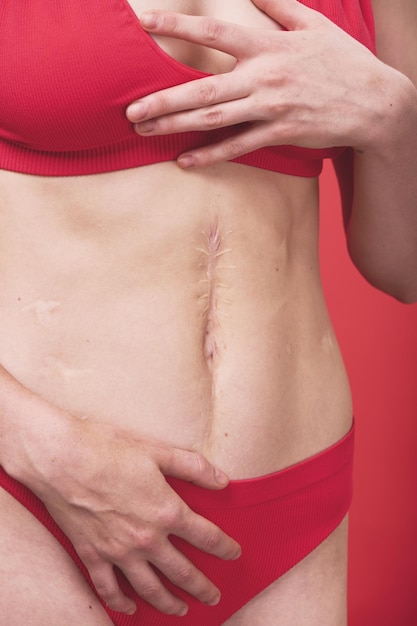 Young female body with scar