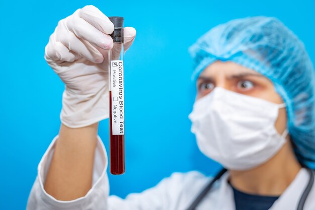 Young female doctor wearing respirator mask holding a positive blood test result for the new rapidly spreading worldwide Coronavirus