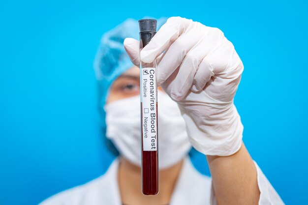 Young female doctor wearing respirator mask holding a positive blood test result for the new rapidly spreading worldwide Coronavirus