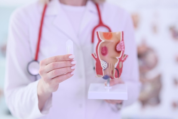 Photo young female doctor with stethoscope shows picture of sick rectum specialist warns about danger