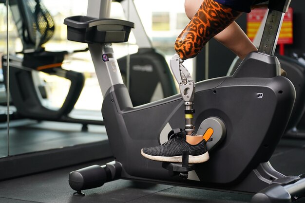 Photo young female with one prosthetic leg with exercising with a spinning bike in the gym