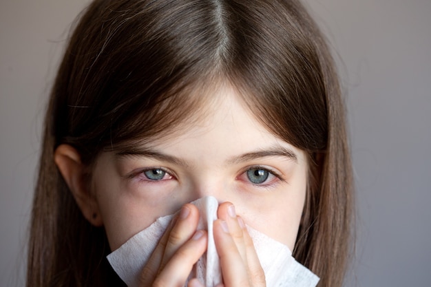 The young girl is allergic, she blows her nose in a napkin. Conjunctivitis, lacrimation, red eyes