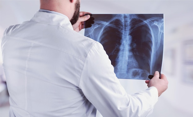 Young male doctor examining x-ray on white