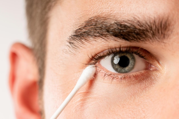 Young man is cleaning his eye with a cotton swab