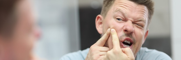 Young man presses pimple while standing in front of mirror in bathroom