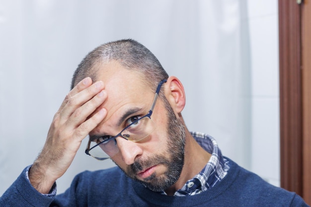 Young man with alopecia looking at his head and hair in the mirror