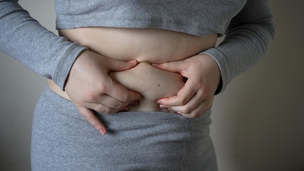 뚱뚱한 큰 배꼽 수술과 지방 분할 개념 xl 크기 사람들의 삶의 지방과 지방 개념을 가진 젊은 과체중 또는 더하기 크기의 여성
