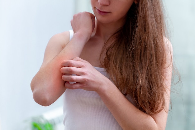 Photo young person suffering from itching on her skin and scratching an itchy place.