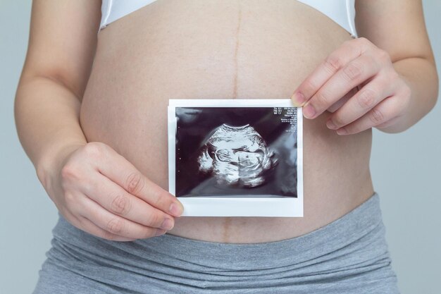 妊娠後期に超音波検査を行う若い妊婦