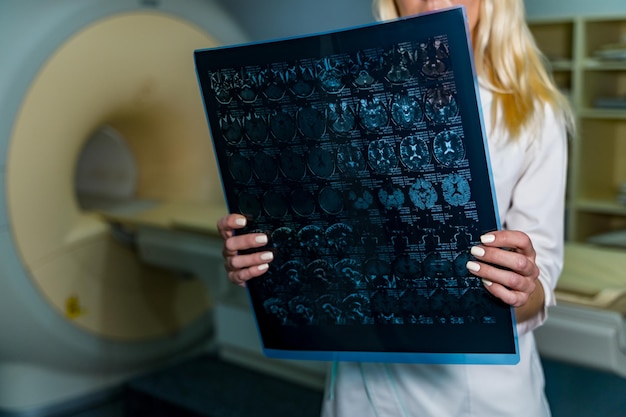 Photo young serious competent female doctor looking at xray at doctor's office computer tomography background